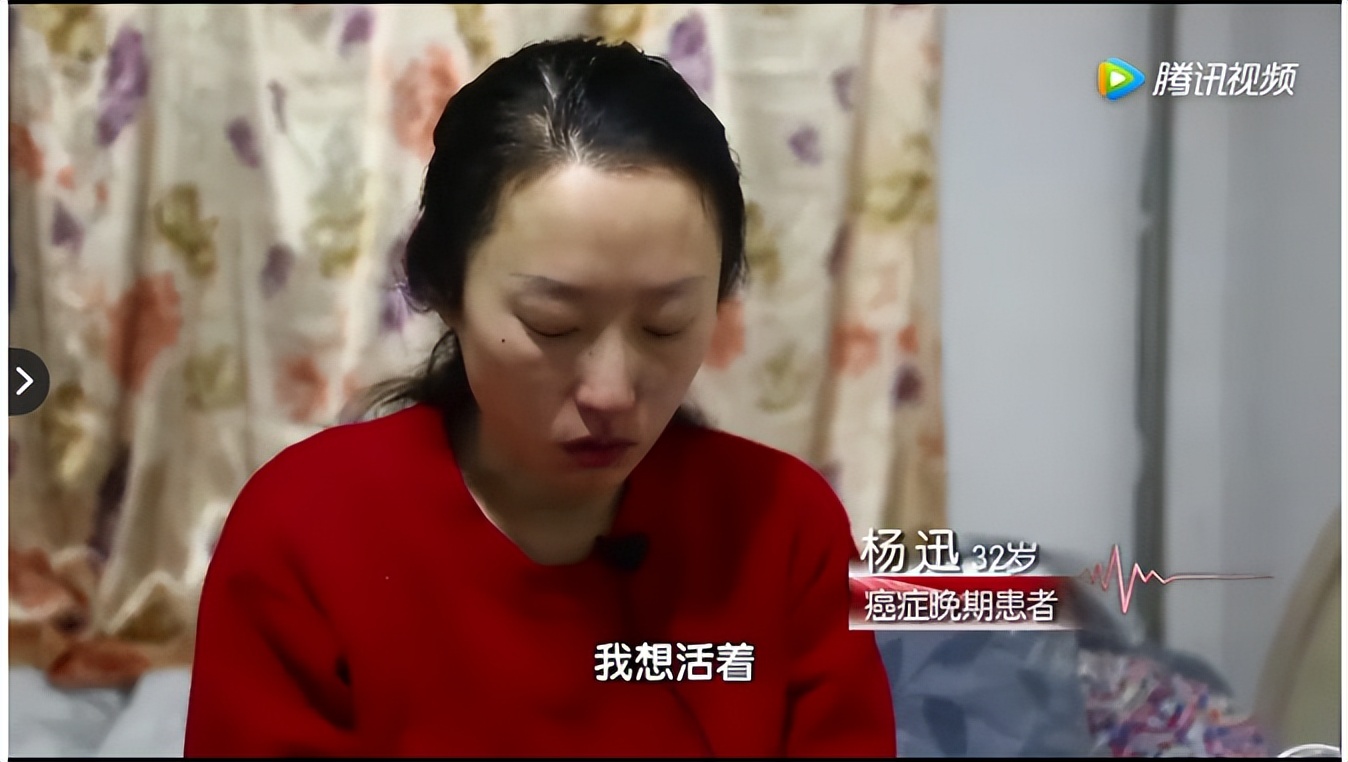 脸上长了很多痣是不是肝癌,这种痣可能是肝癌信号