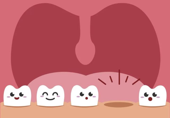 种植牙拔了做矫正,种植牙齿全过程真相大揭秘