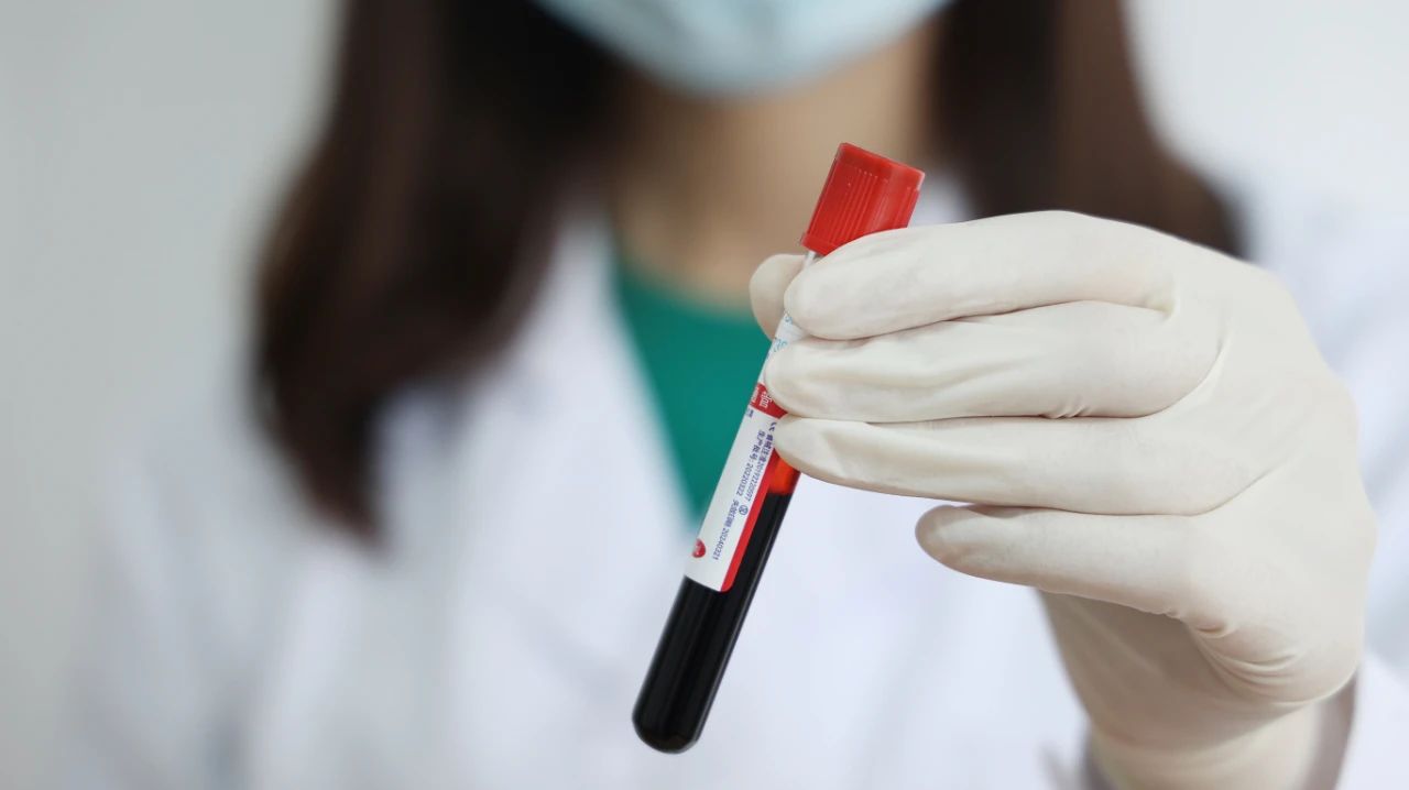 血脂高与高脂血症的区别,高脂血症的指南诊断标准