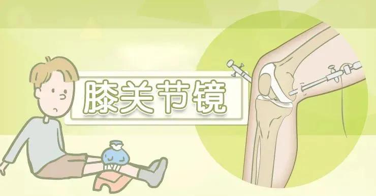 关节镜可以找到膝盖疼的原因吗,膝盖关节镜副作用