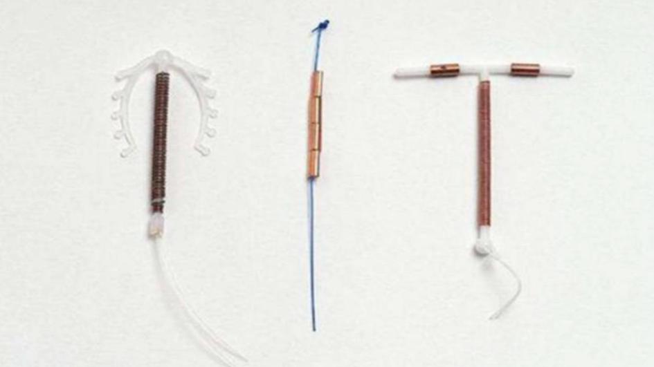 节育环更年期后是否要取出,节育环一直不取绝经后出血