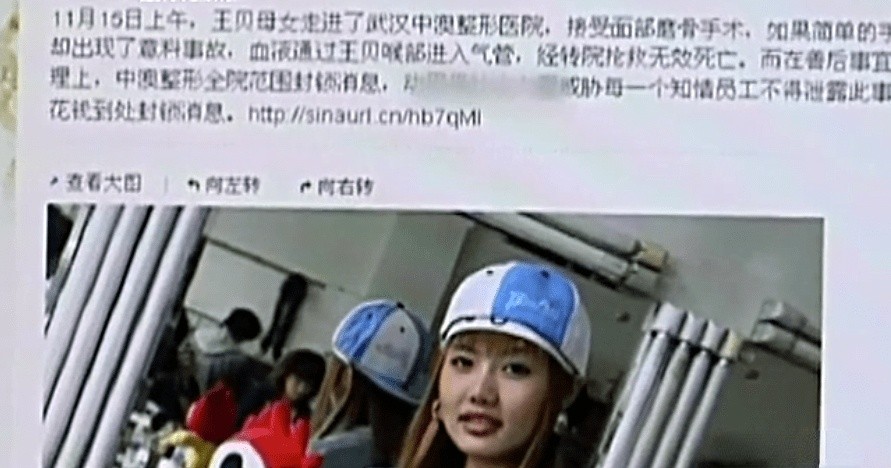 女歌手整容失败索赔100万,女歌手整容失败索赔2019