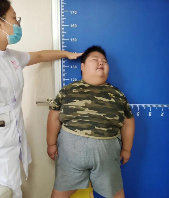 小孩肥胖达到减重指标,幼儿身高体重肥胖粗略评估方法