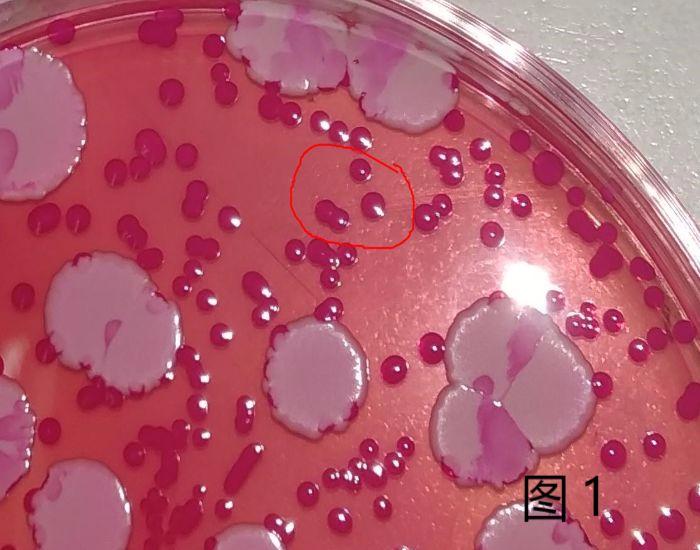 霉菌酵母菌检测方法视频,霉菌和酵母菌的国标检测方法