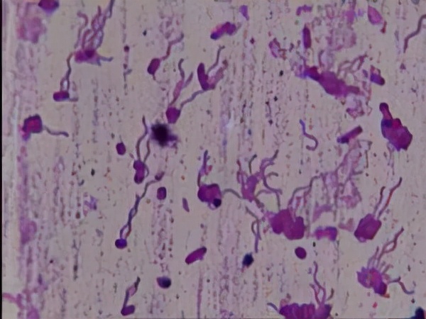 鞭毛染色要注意哪些环节,细菌的鞭毛染色