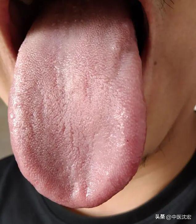 舌红阴虚有热，舌白血虚有寒，舌胖气虚有湿，中医教你从舌象看病