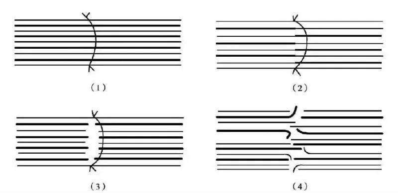 修复神经的最好方法,神经修复的最佳时间表