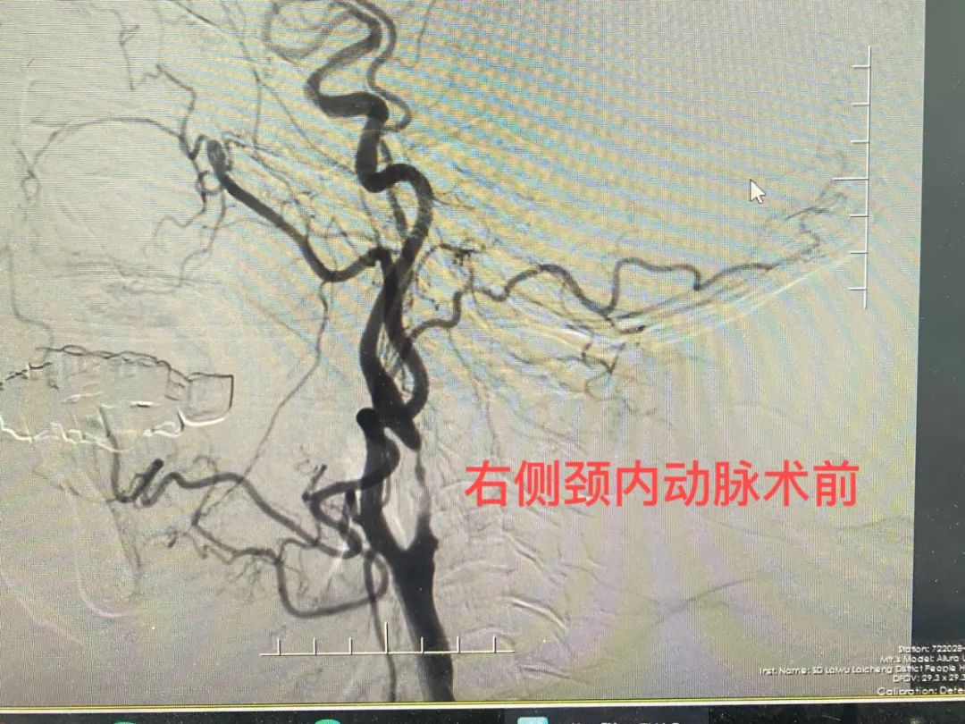济南市莱芜人民医院口镇分院,山东打通生命通道济南