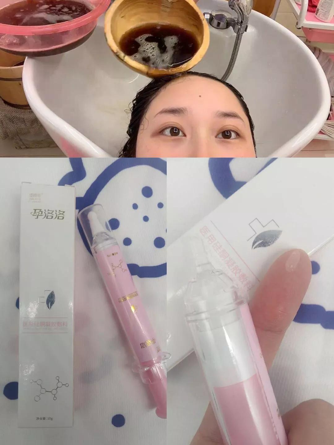 剖腹产后注意事项及技巧,剖腹产后肚子上的肉下垂怎么减掉