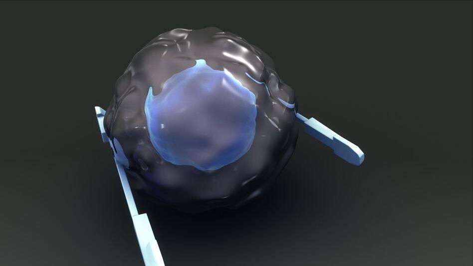 为什么高尿酸不建议吃非布司他,尿酸高伤害哪些内脏