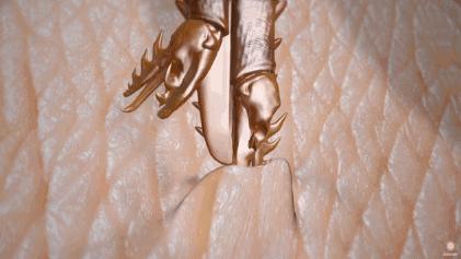 夏季常见蚊虫叮咬图鉴,女孩被家人吸血10年