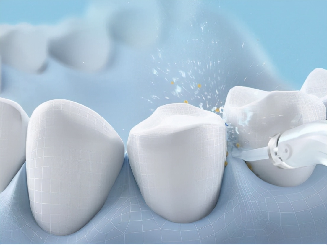 水牙线冲牙器第一名,水牙线冲牙器第一名旗舰店