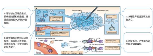 乳腺肿瘤有什么特效药吗,不用开刀治肿瘤的仪器