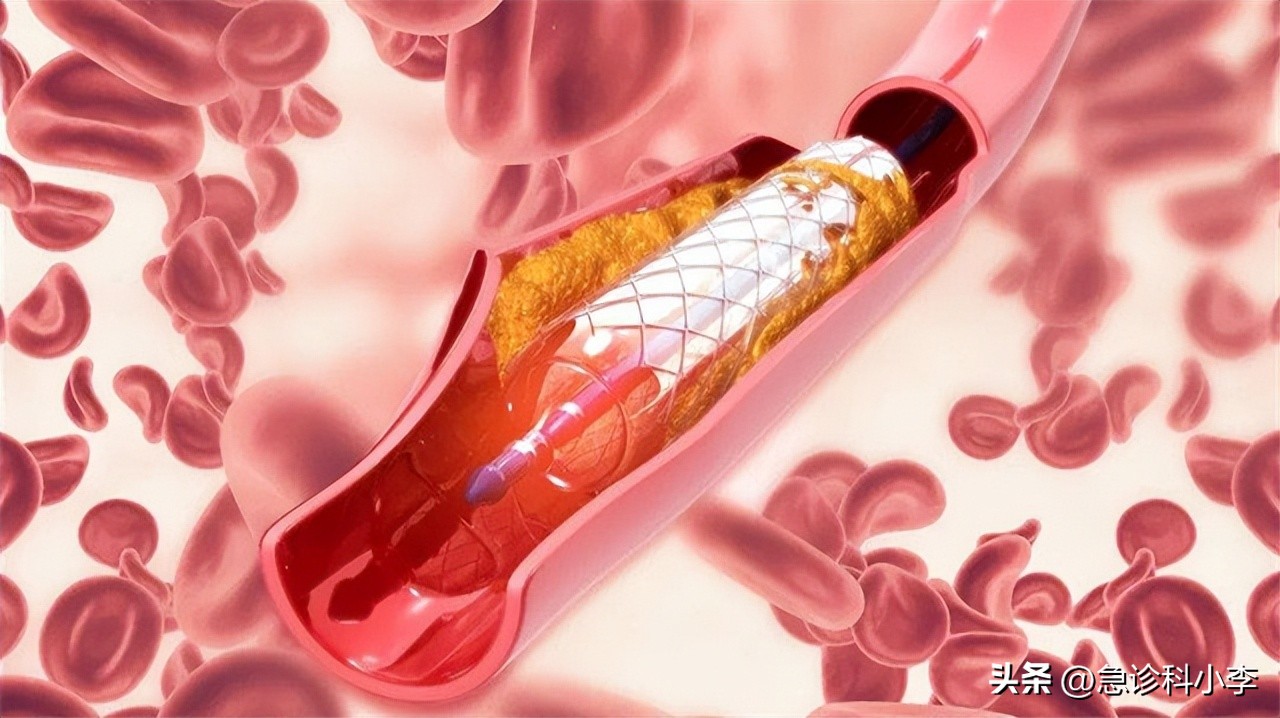 哪种油是不健康的,花生油对人体有什么好处和坏处