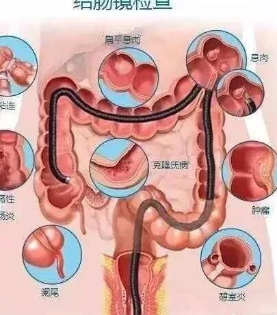 我们从嘴到肛门有多长，从外面看是不到1米，里面呢？