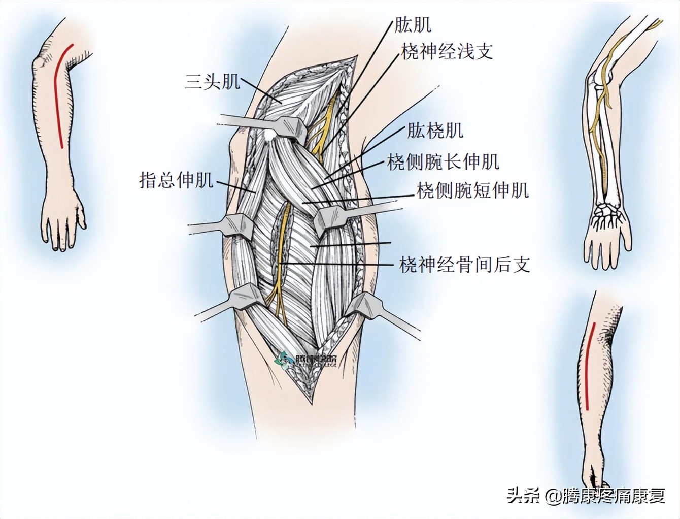 前臂疼痛，这五个动作就能缓解