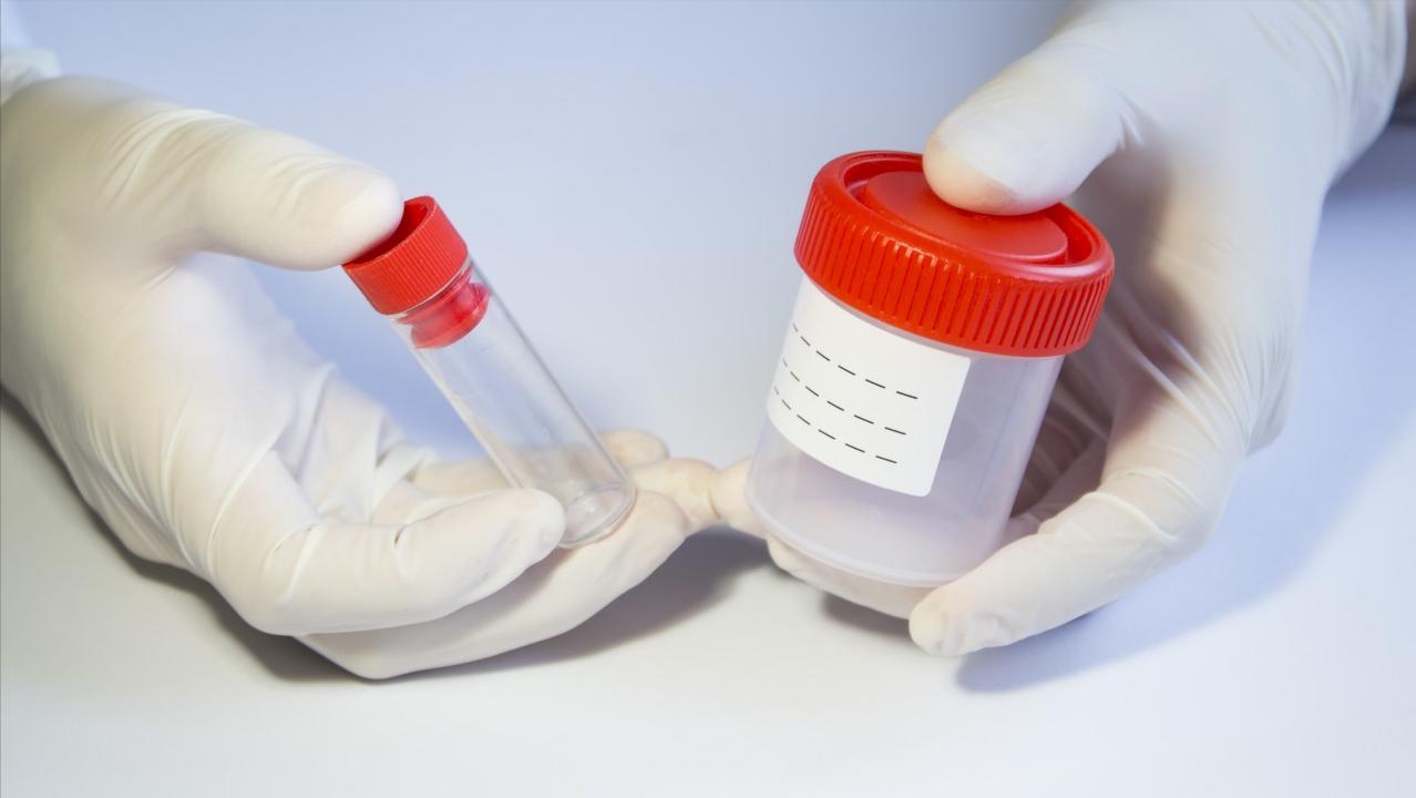 肺部有痰咳不出来的解决妙招,肺部咳出很多痰是快好了么