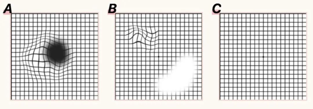 疫情居家隔离用眼多,干涩酸胀有妙招!