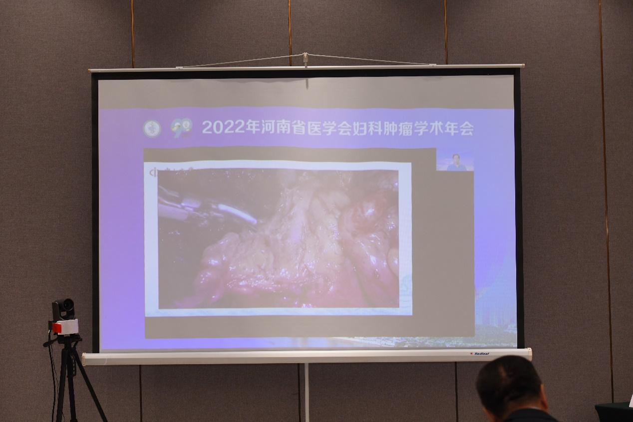 「年会纪要」2022年河南省医学会妇科肿瘤学术年在郑州成功召开