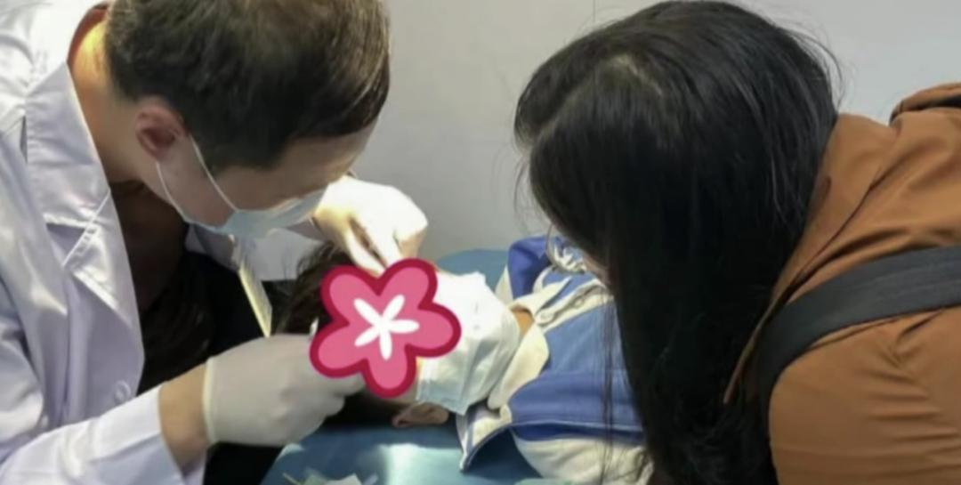 502不小心溅到眼睛里了怎么办,502溅了一点点进眼睛里了怎么办