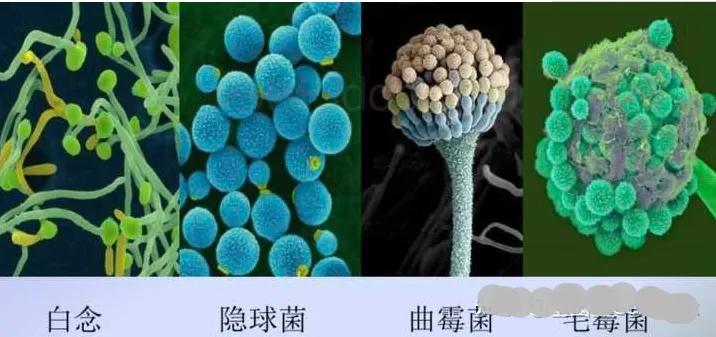 洗纹身真的不是一般人能承受的,洗纹身真的要下很大的决心