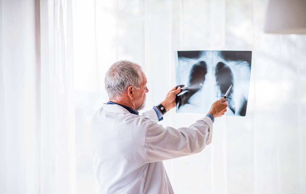 肺癌是发病率最高的恶性肿瘤,恶性程度比较高的肺癌