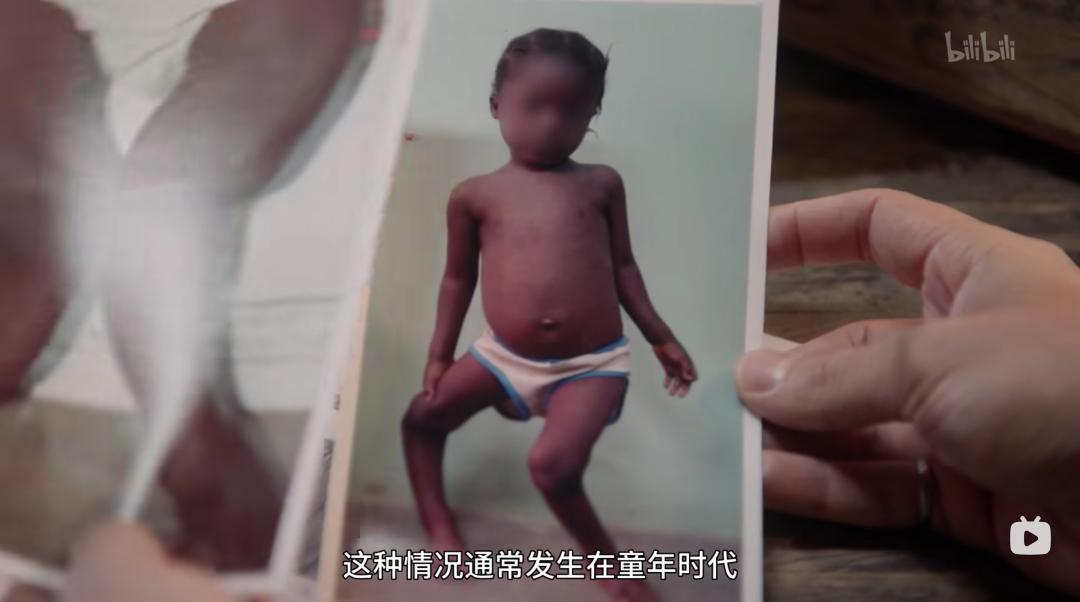 阳了补充维生素c有用吗,各种维生素该不该补