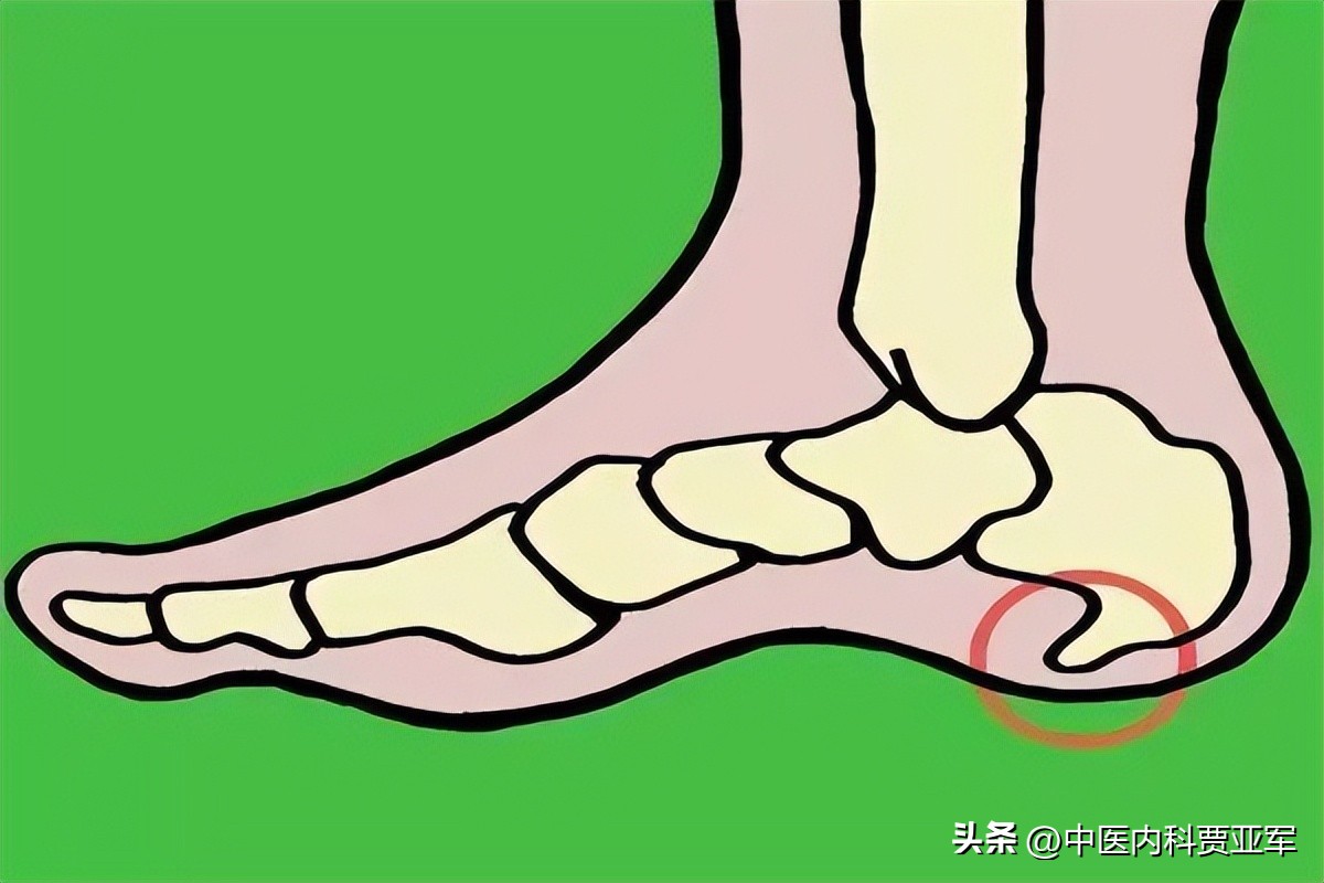 足跟骨刺可以喝什么中药,足跟骨刺痛用什么中药最好