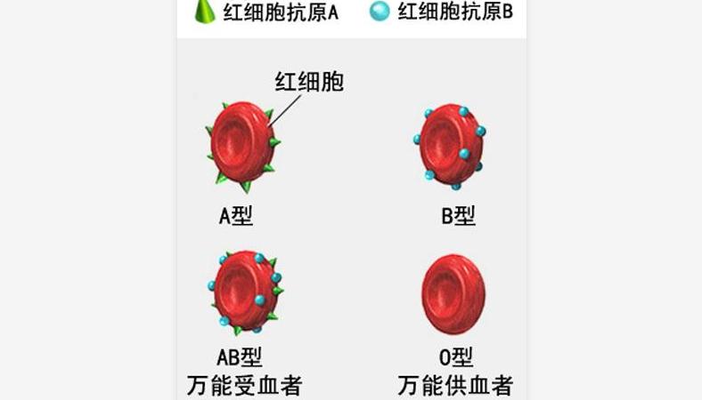 哪种血型的人更容易患上老年痴呆,血型和痴呆
