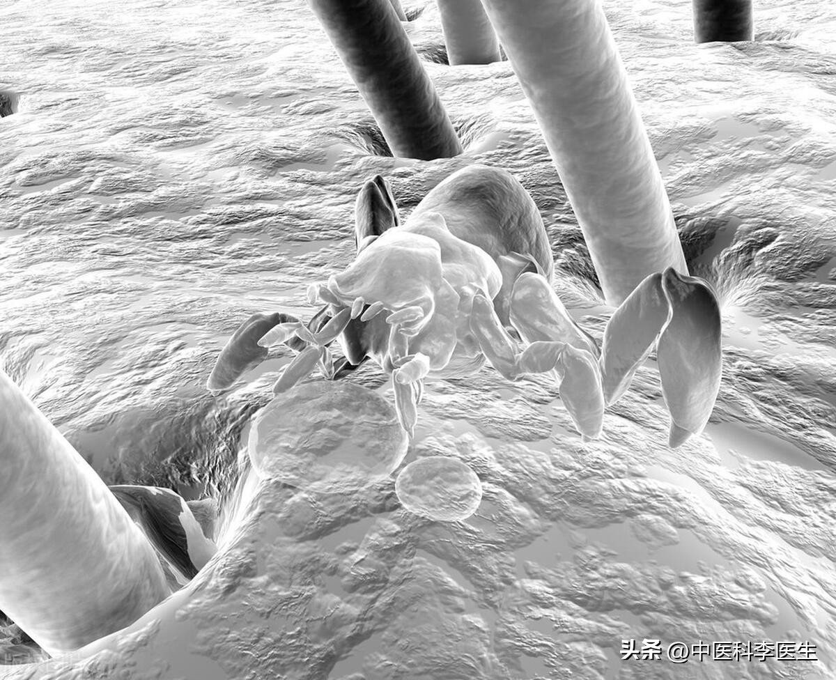 下体瘙痒发现两三只阴虱严重吗,阴部有几十只阴虱