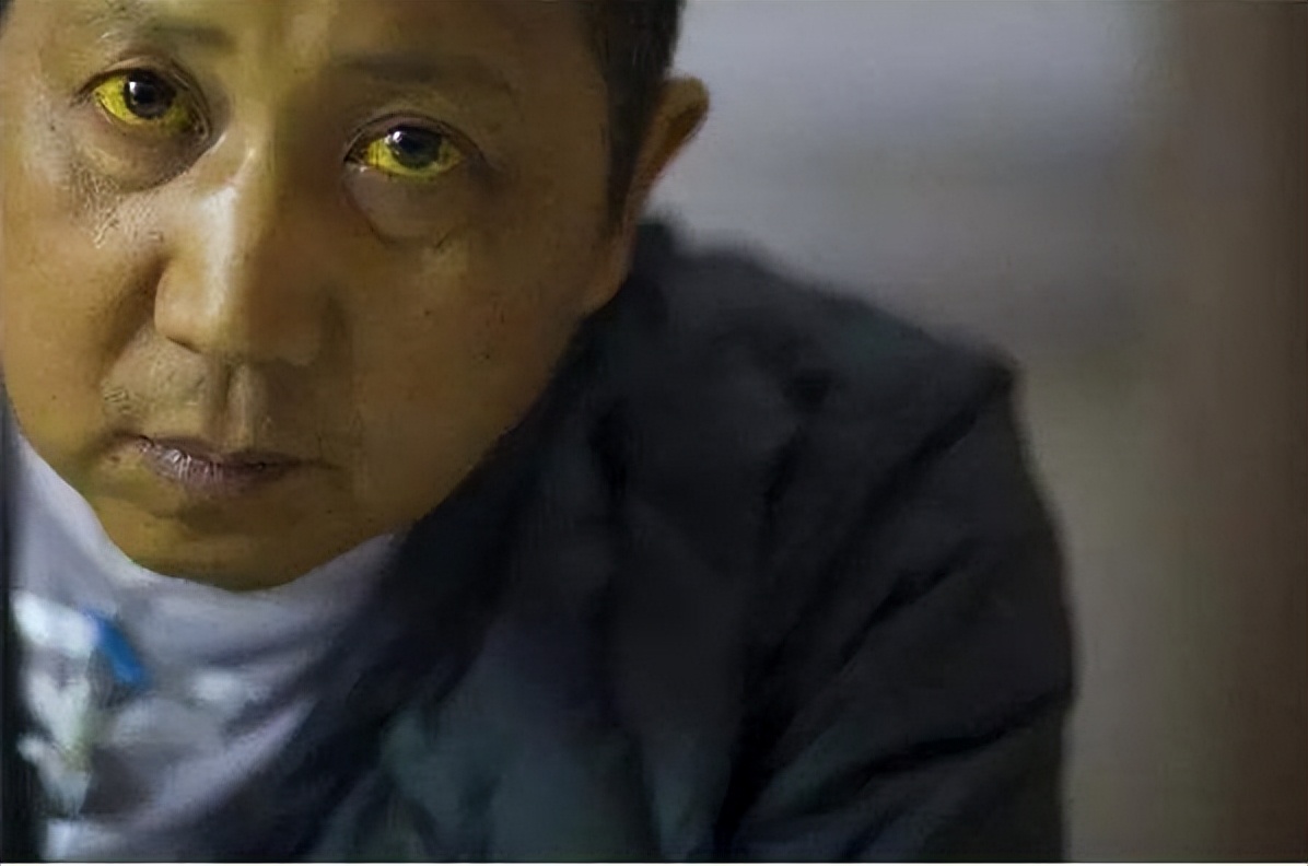 乙肝不宜吃鹅肉,鹅肉乙肝病人能吃吗