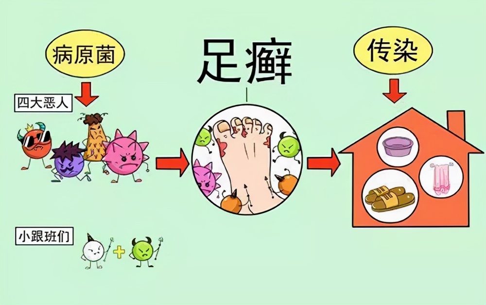 手足癣怎么治疗最有效,手足癣怎么治疗最快最有效