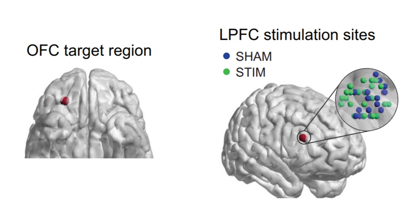 谷氨酸含量升高,谷氨酸过高对大脑有什么危害