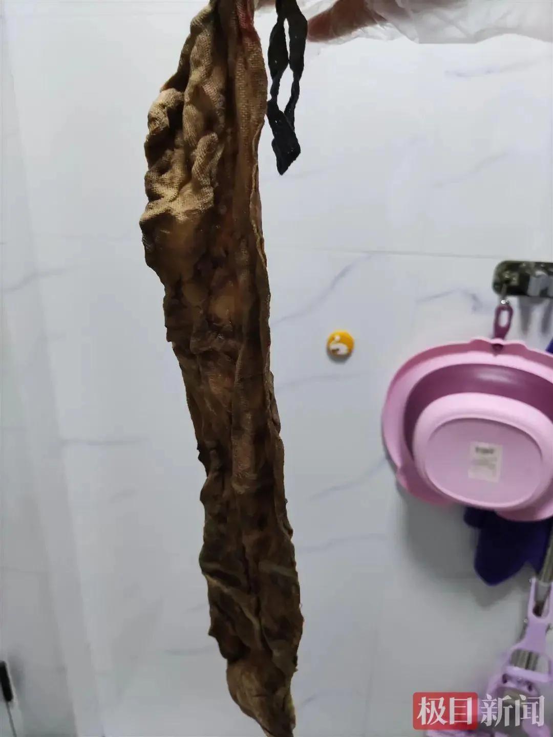 女子产后不久发现腹内遗留纱布，找医院竟称：不是医院求你生孩子