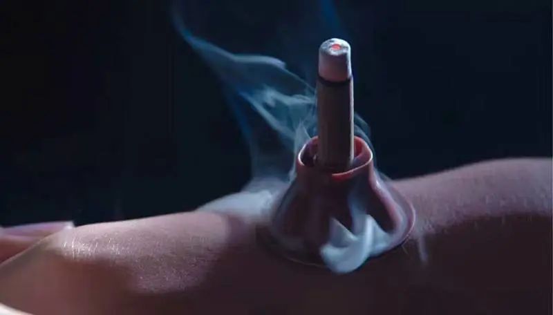 董氏二针疗法,董氏奇穴三阴二阳常用穴位