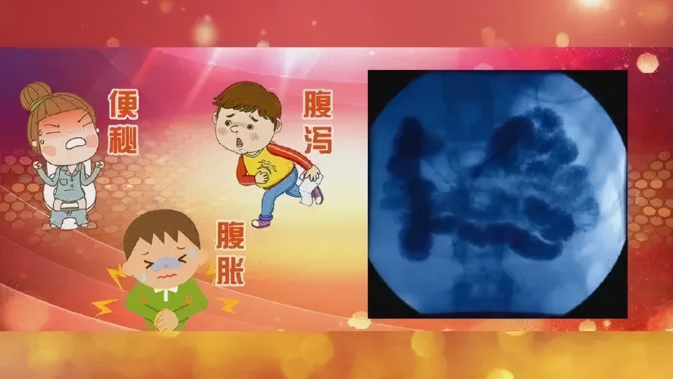 27岁女子每天放屁数十次,竟被确诊肠癌晚期!这2种臭屁尤其危险