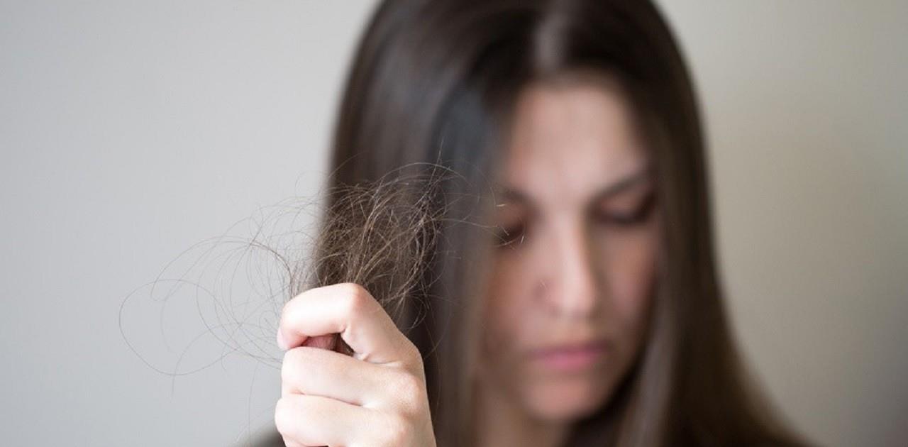 洗头会导致脱发秃头吗,女子怕头秃三个月不洗头后续