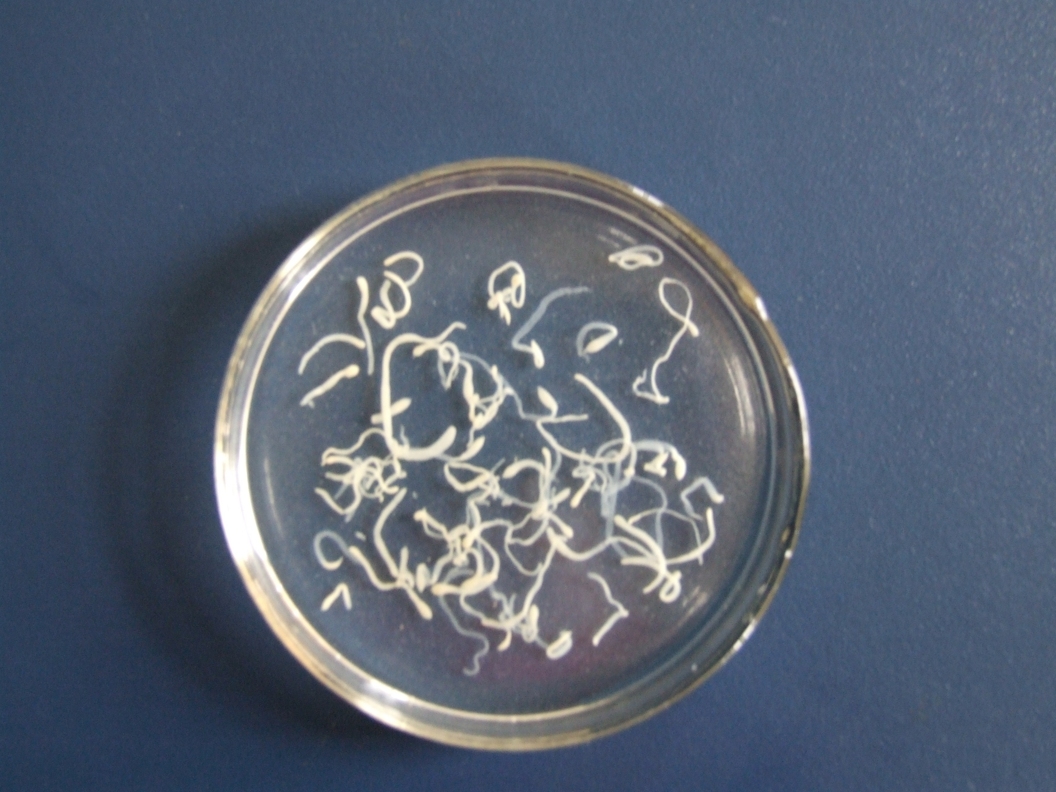 为什么牛肉可以生吃猪肉不可以,牛肉可以生吃为什么猪肉不行