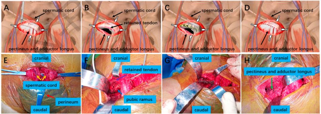 楠ㄧ闄堝崕,闄堝崕鍦ㄥ尰闄㈢殑瑙嗛