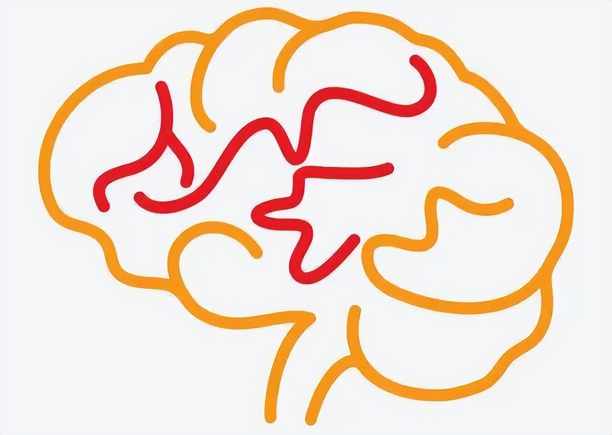 70岁母亲头晕头上长了恶性肿瘤,50多岁阿姨经常头疼