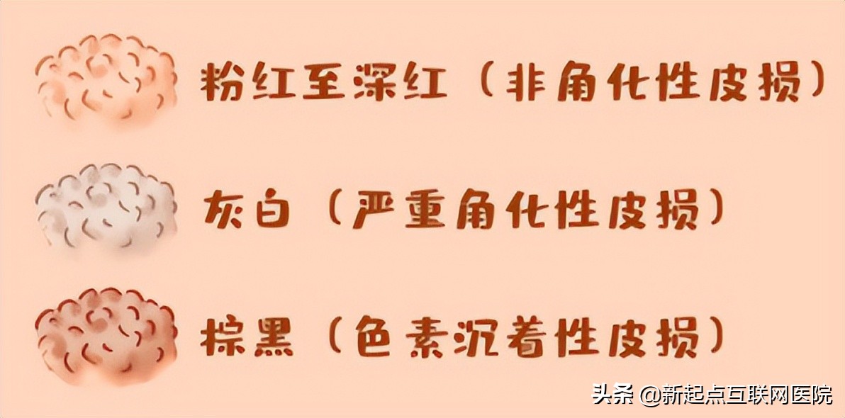 下面长了白色的疙瘩用什么药,下面长红色小疙瘩很痒是什么情况