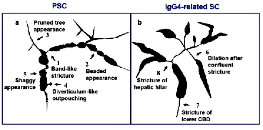 贾继东教授乙肝治愈主要药物,肝病专家贾继东抖音号