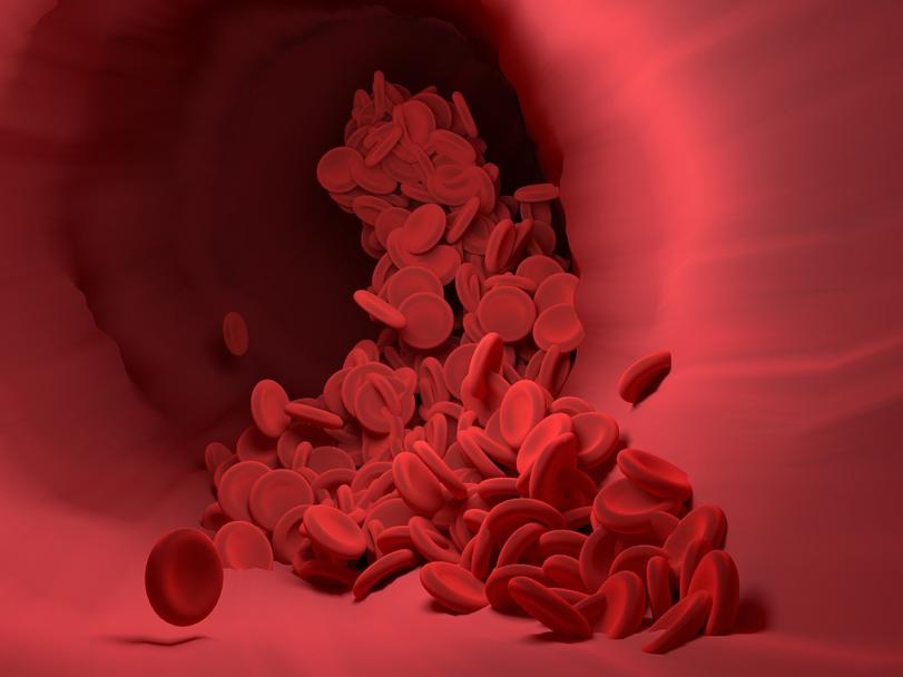 怎么判断采血管溶血,抽血化验溶血需要重新抽怎么回事