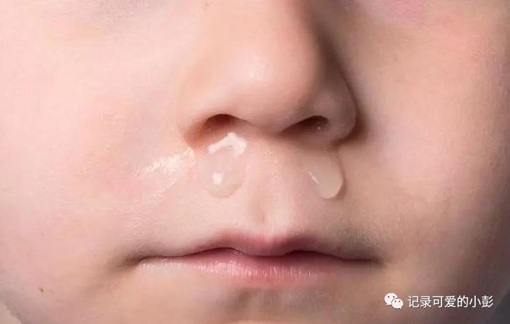 一岁宝宝喝奶时突然流了一点鼻血,一岁宝宝喝奶后鼻涕流不止