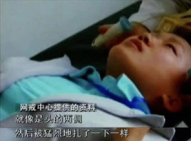 被杨永信戒断网瘾的孩子,电击治疗网瘾学校杨永信