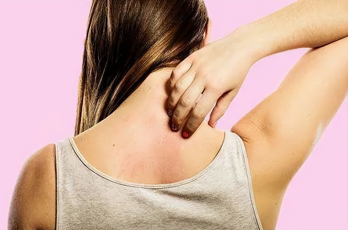 一到晚上就荨麻疹风团是什么原因,皮肤瘙痒荨麻疹的原因及治疗方法