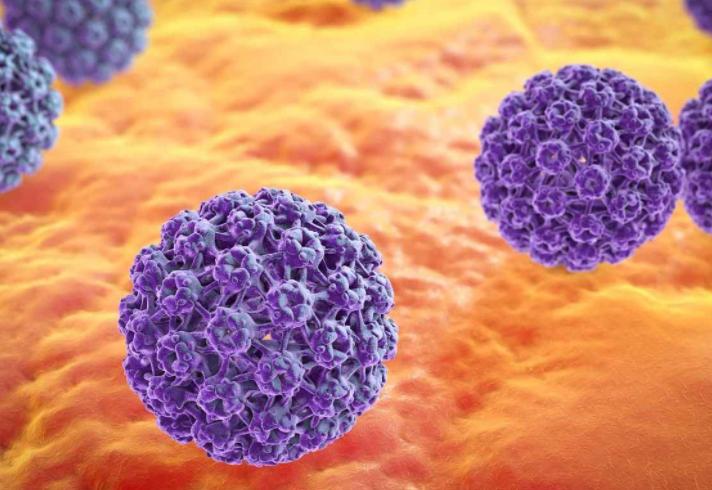 90多岁阴茎癌需要手术吗,男性阴茎癌手术后能活多久