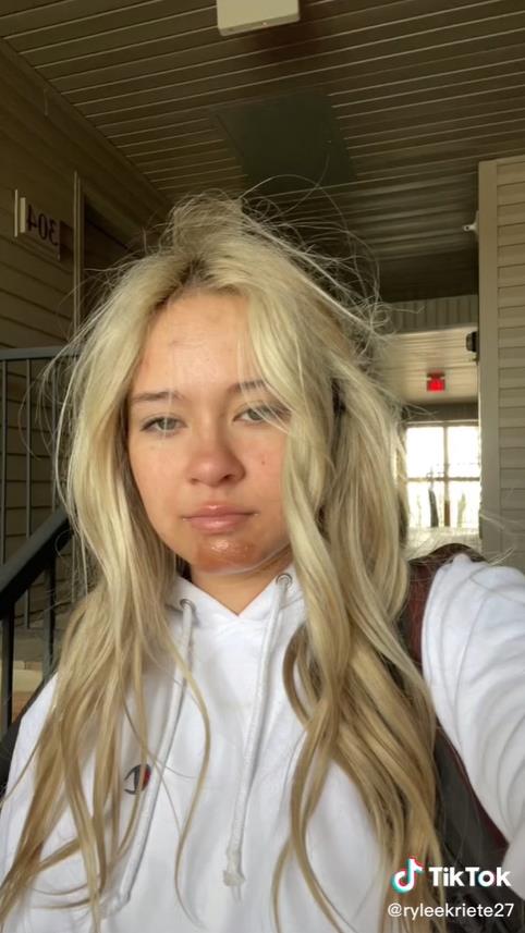 澳洲妹子和男友接吻,澳大利亚女子与男友接吻