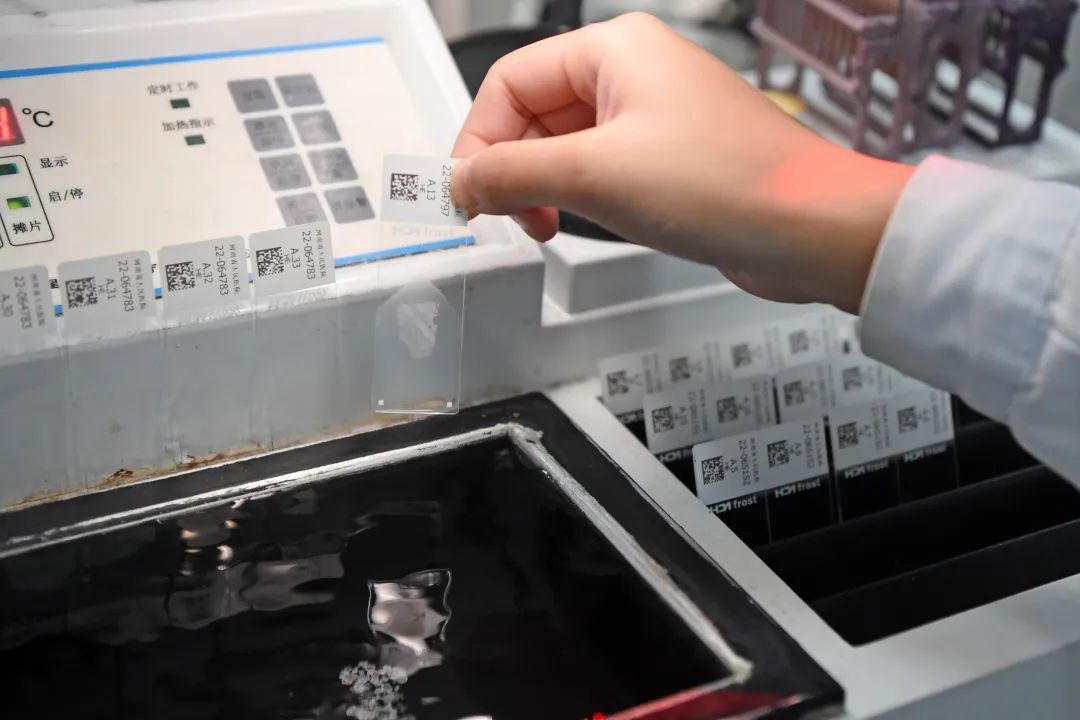 医生说病理报告有点小问题,病理报告没出来好害怕啊