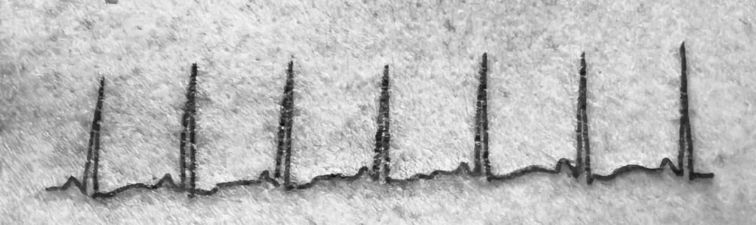 田州小镇近千人送别！来自中国的女孩，短暂却璀璨的一生